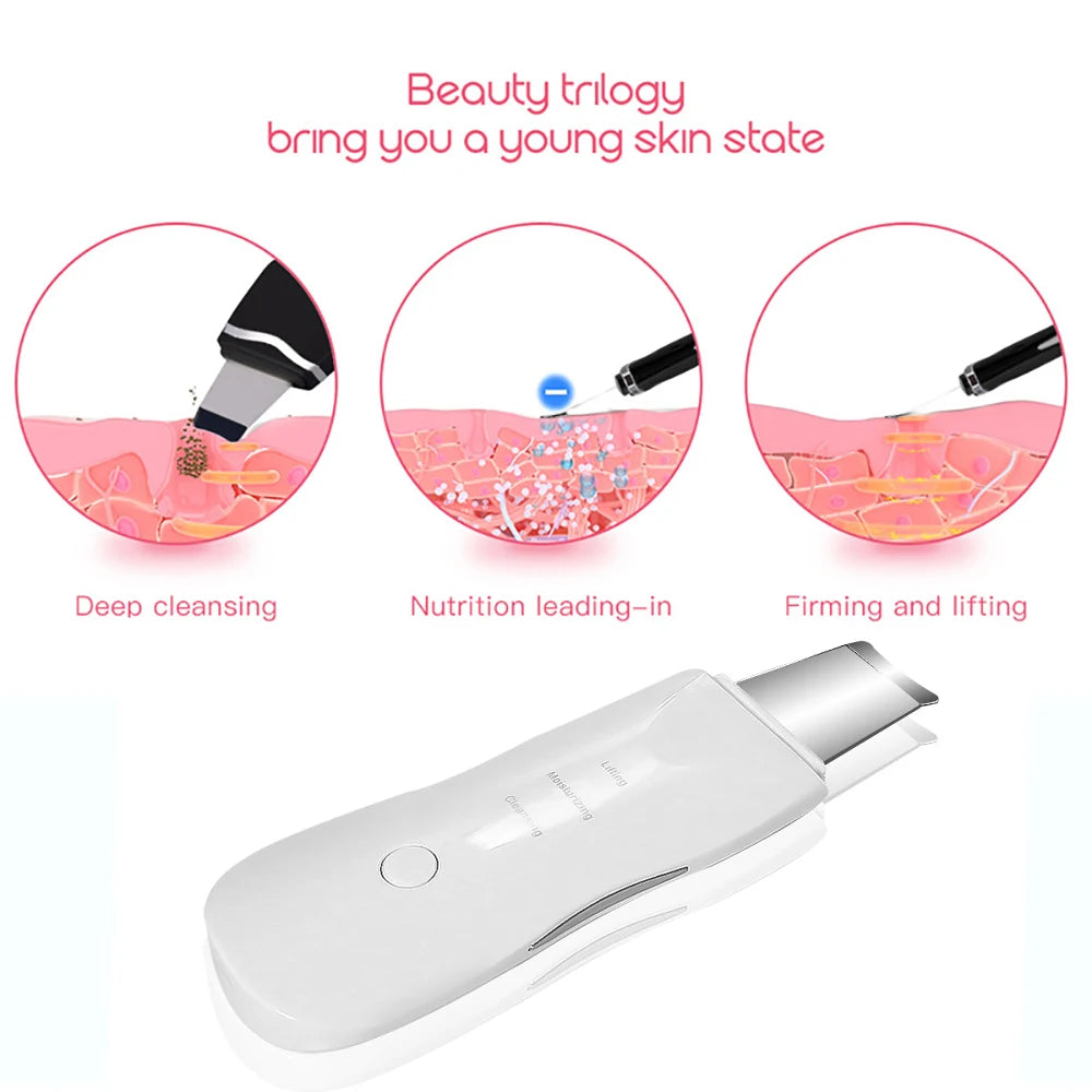 Ultrasonic Blackhead Remover Cleaner - Vivian