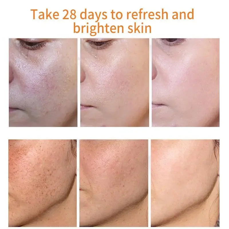 Freckle whitening cream, melasma and dark spots removal - Vivian