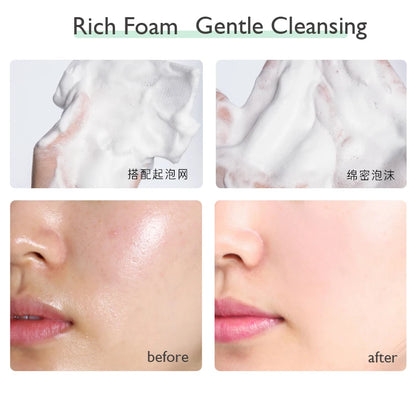 Milk Acne Whitening Foam Facial Cleanser - Vivian