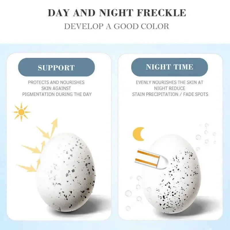 Freckle whitening cream, melasma and dark spots removal - Vivian