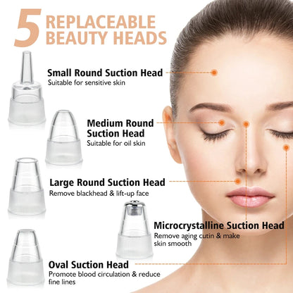 Electric Blackhead Remover - Vivian