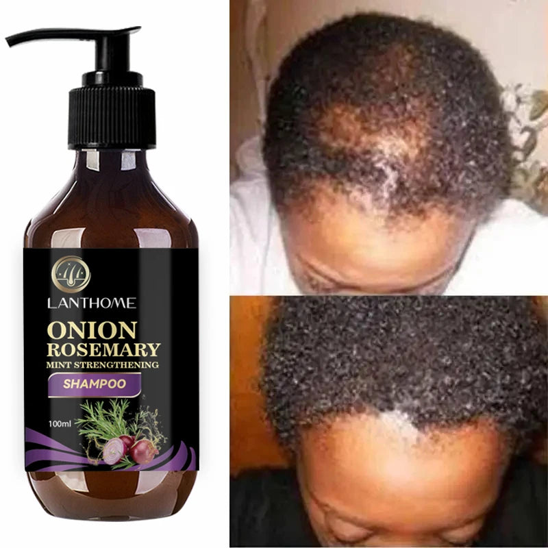 Onion and rosemary shampoo and spray