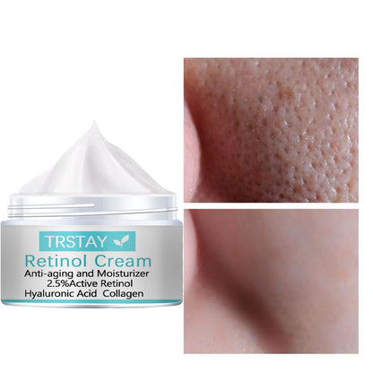 Freckle whitening cream, melasma and dark spots removal - Vivian