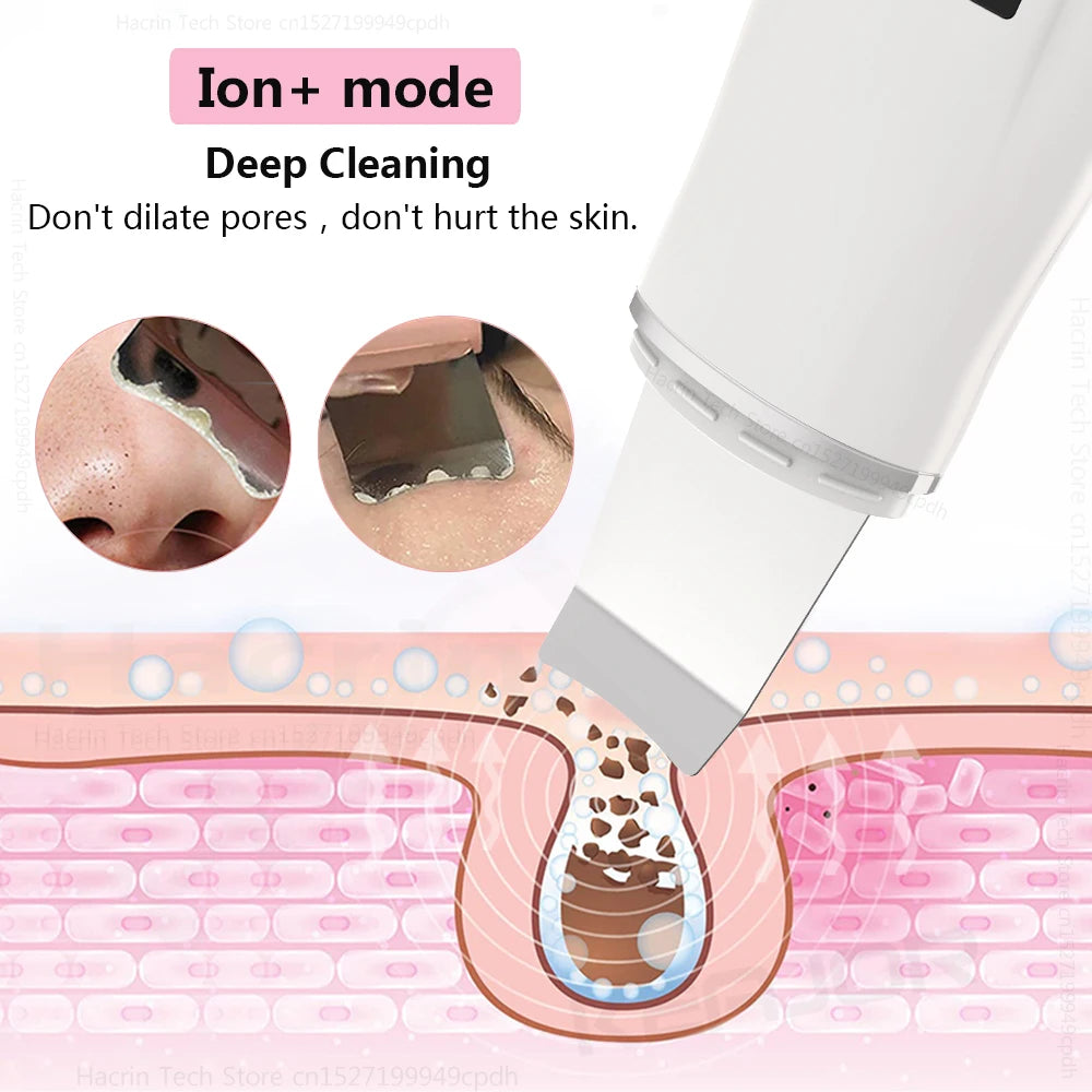 Ultrasonic Cleaner, Exfoliator and Blackhead Remover - Vivian